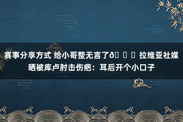 赛事分享方式 给小哥整无言了😅拉维亚社媒晒被库卢肘击伤疤：耳后开个小口子